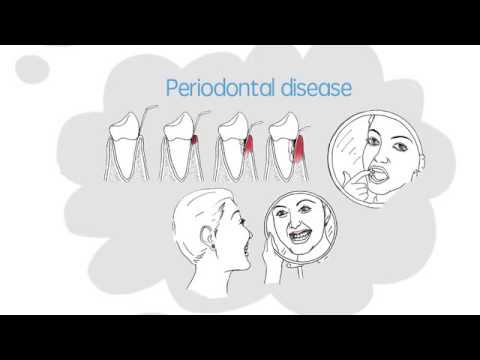 Dental Well being